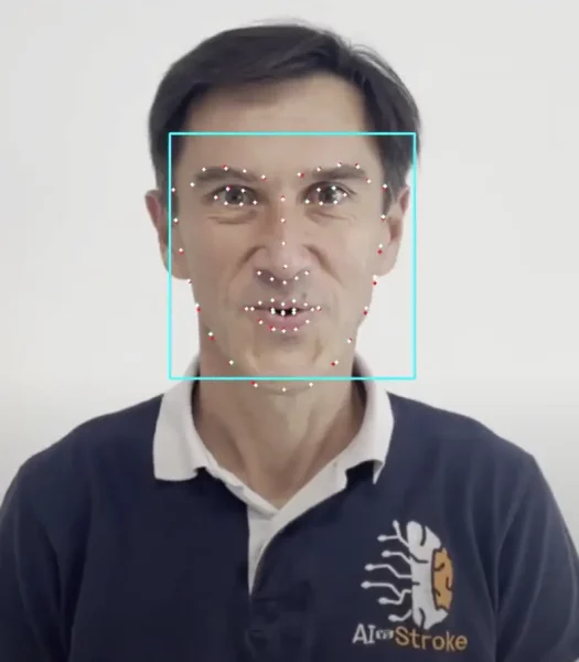 L’IA recherche dans l’image les symptômes d’un AVC.
©  AI-Stroke